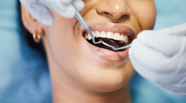 Best Emergency Tooth Extraction in Salem, IL